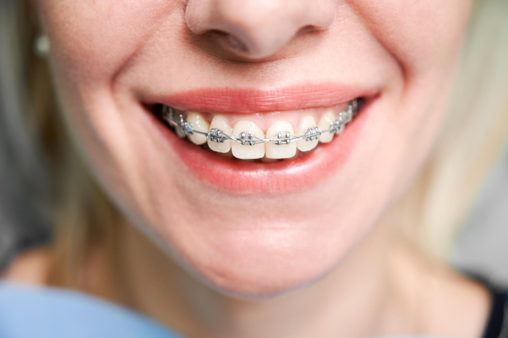 orthodontic services  Germantown, MD ,  Manassas, VA
