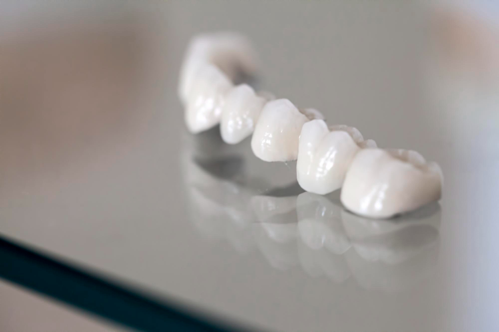 Porcelain Crowns  Germantown, MD ,  Manassas, VA